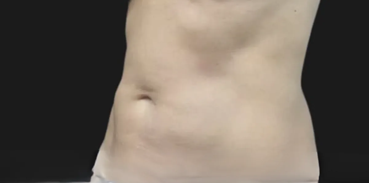 Body at Sona MedSpa